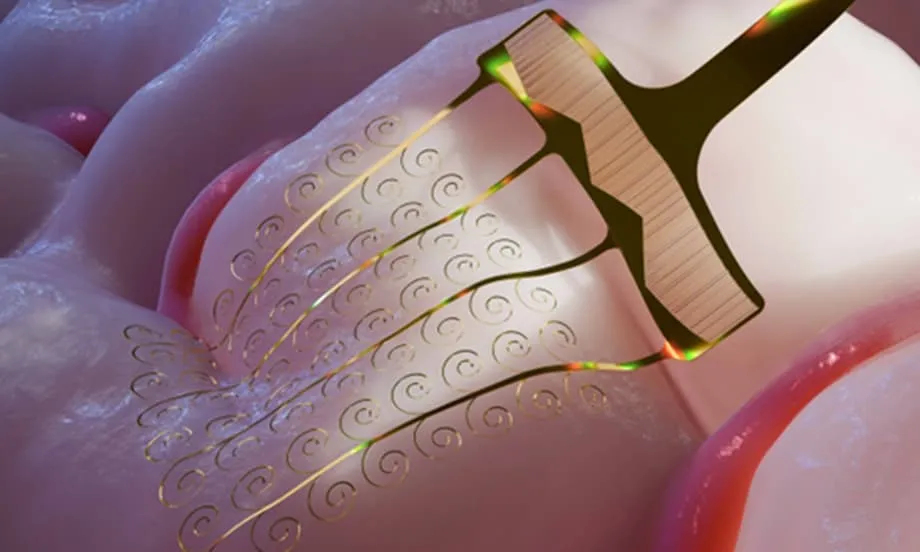 Científicos chinos desarrollan electrodos cerebrales extensibles y superan una barrera clave para la tecnología controlada por el pensamiento