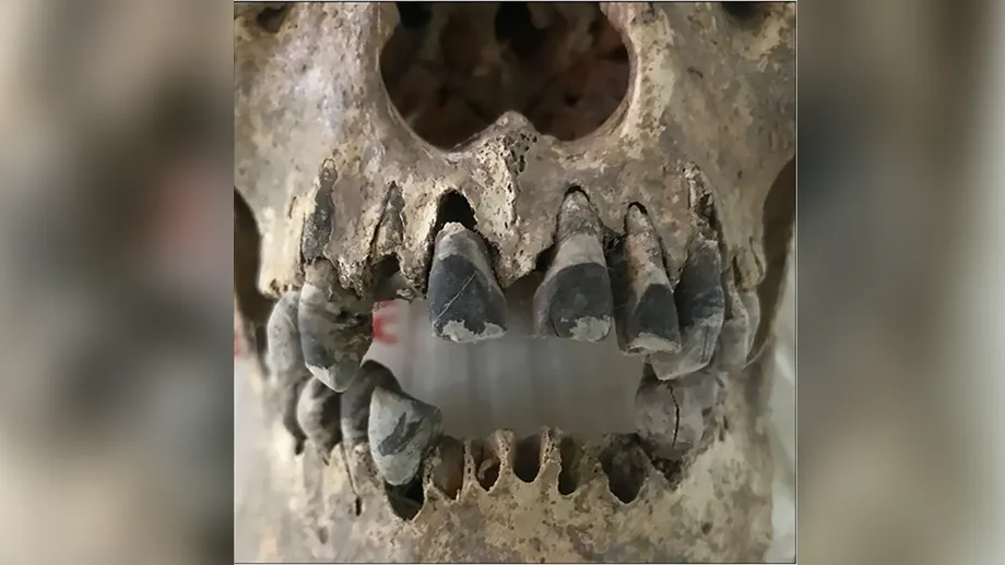 Dientes ennegrecidos en el antiguo Vietnam: cómo las comunidades de la Edad del Hierro crearon un ideal de belleza que perduró 2.000 años